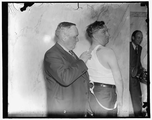 PovijesneFindings Foto: Predstavnik sindikata prikazuje primljene rane od metaka, šerifi okruga Harlan, 1937